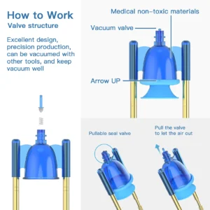 Vacuum Traction Kit V3.0 – SizeDoctor by Size Master